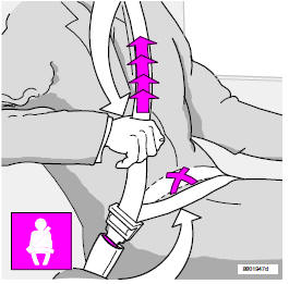 Extension de la sangle sous-abdominale